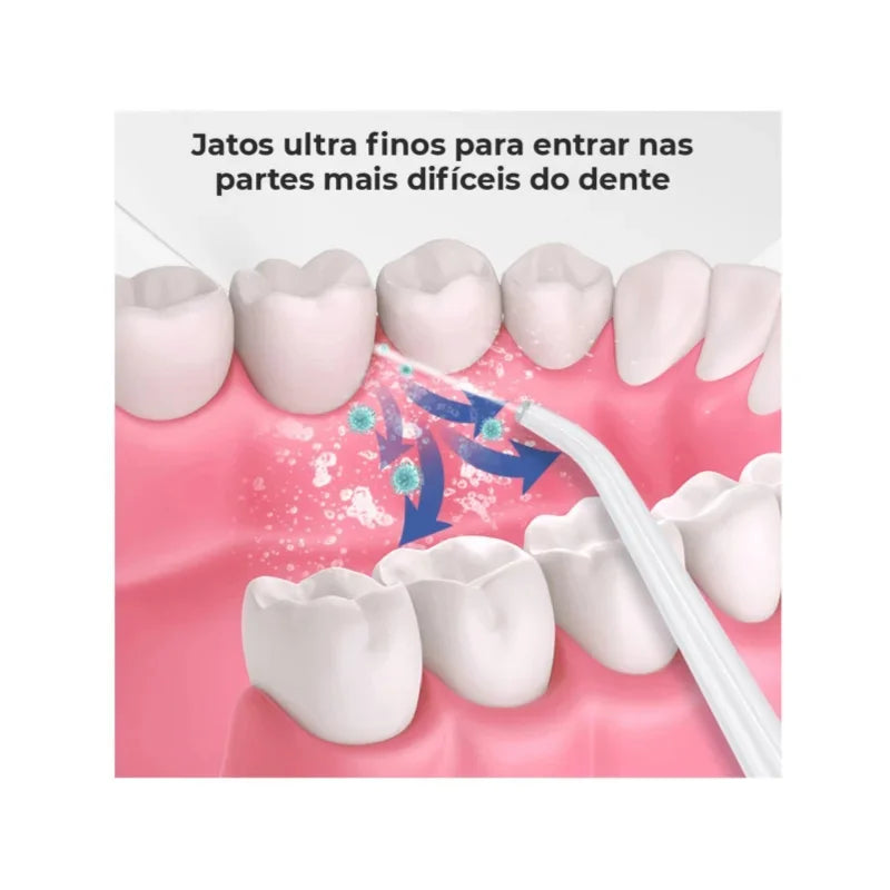 Irrigador Oral Portátil com 3 Níveis de Jato | Hey Sister